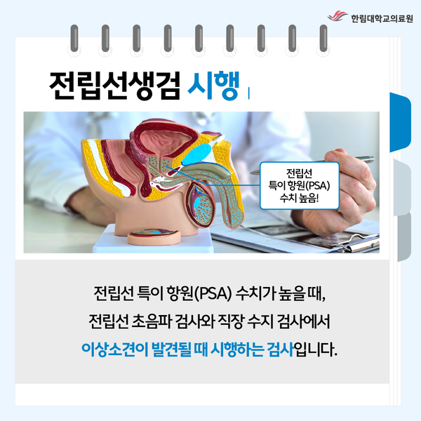 전립선암 조기 발견하는 전립선생검 안내
